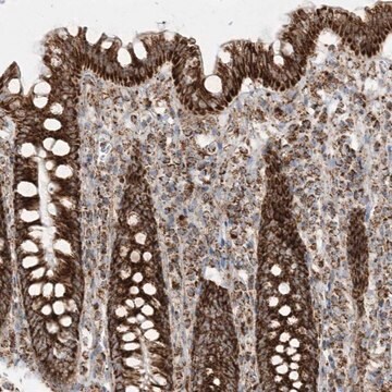 Anti-MRPS36 antibody produced in rabbit Prestige Antibodies&#174; Powered by Atlas Antibodies, affinity isolated antibody, buffered aqueous glycerol solution