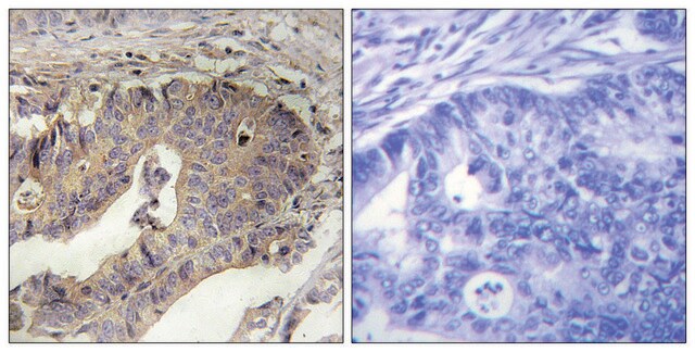 Anti-Fibrillin-1 antibody produced in rabbit affinity isolated antibody