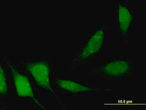 Monoclonal Anti-DIP13B antibody produced in mouse clone 1C10, purified immunoglobulin, buffered aqueous solution