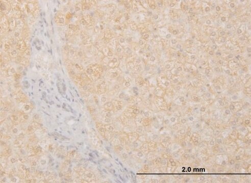 Monoclonal Anti-POMGNT1 antibody produced in mouse clone 6C12, purified immunoglobulin, buffered aqueous solution