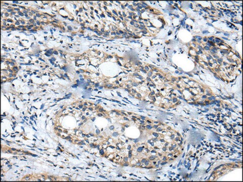 Anti-WDFY2 affinity isolated antibody