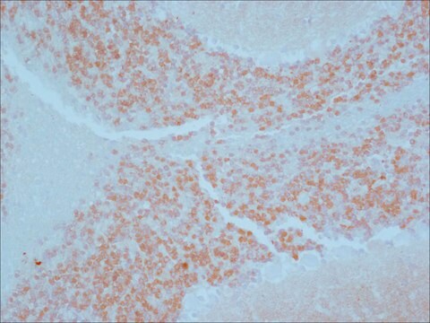 Anti-Calretinin antibody produced in rabbit affinity isolated antibody, buffered aqueous solution