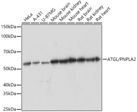 Anti-ATGL/PNPLA2 Antibody, clone 10Y4M10, Rabbit Monoclonal