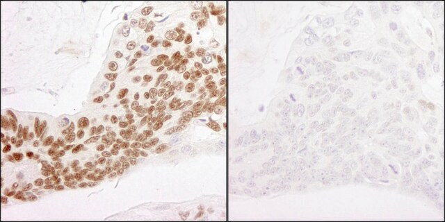 Rabbit anti-Phospho RNA Polymerase II (S2) Antibody, Affinity Purified Powered by Bethyl Laboratories, Inc.