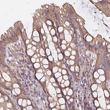 Anti-ARHGEF39 antibody produced in rabbit Prestige Antibodies&#174; Powered by Atlas Antibodies, affinity isolated antibody, buffered aqueous glycerol solution