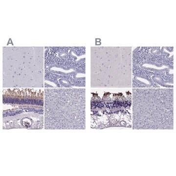 Anti-PDE6A antibody produced in rabbit Prestige Antibodies&#174; Powered by Atlas Antibodies, affinity isolated antibody, buffered aqueous glycerol solution