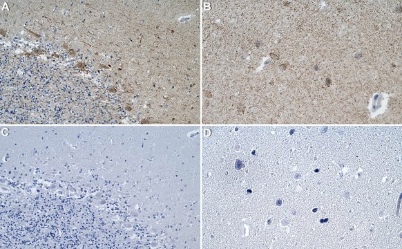 Anti-GPR37 Antibody, clone 1E14 ZooMAb&#174; Rabbit Monoclonal recombinant, expressed in HEK 293 cells