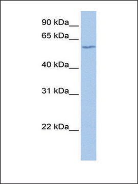 Anti-DNTT antibody produced in rabbit affinity isolated antibody