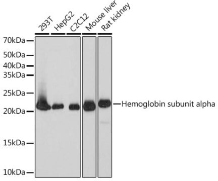 Anti-DHFR Antibody, clone 7N3X4, Rabbit Monoclonal