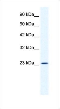 Anti-KCTD11 antibody produced in rabbit affinity isolated antibody