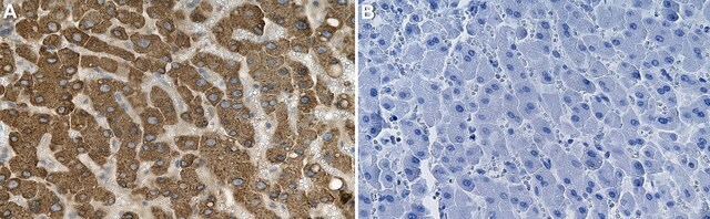 Anti-hCE-1/CES1 Antibody, clone 1D4 ZooMAb&#174; Rabbit Monoclonal recombinant, expressed in HEK 293 cells