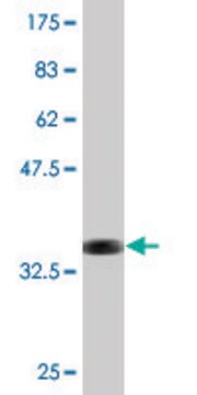 Monoclonal Anti-ITGB6 antibody produced in mouse clone 4C3, purified immunoglobulin, buffered aqueous solution