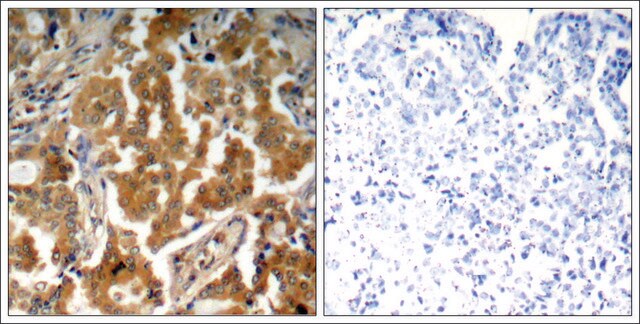 Anti-phospho-ADD1 (pSer726) antibody produced in rabbit affinity isolated antibody