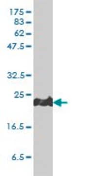 Monoclonal Anti-PRDX1 antibody produced in mouse clone 4B11-D10, purified immunoglobulin, buffered aqueous solution