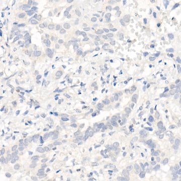 Anti-EGFR (L858R) Antibody, clone 1J5C6, Rabbit Monoclonal