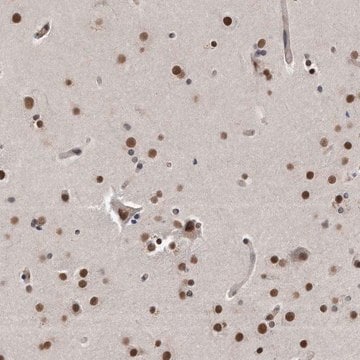 Anti-TP53INP1 antibody produced in rabbit Prestige Antibodies&#174; Powered by Atlas Antibodies, affinity isolated antibody, buffered aqueous glycerol solution