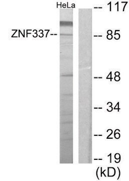 Anti-ZNF337 antibody produced in rabbit affinity isolated antibody