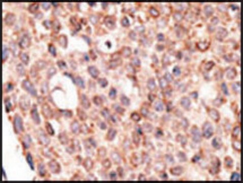 Anti-Cry2 (C-term) antibody produced in rabbit IgG fraction of antiserum, buffered aqueous solution