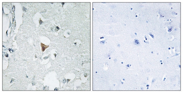 Anti-SAPK antibody produced in rabbit affinity isolated antibody