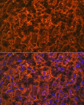 Anti-PLGF Antibody, clone 6N4V2, Rabbit Monoclonal