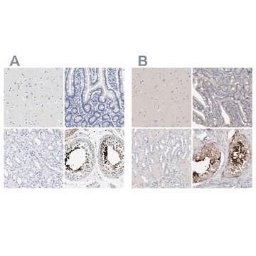 Anti-ACTL7B antibody produced in rabbit Prestige Antibodies&#174; Powered by Atlas Antibodies, affinity isolated antibody, buffered aqueous glycerol solution