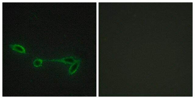 Anti-FUK antibody produced in rabbit affinity isolated antibody