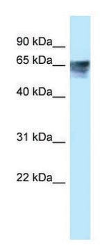 Anti-THRA antibody produced in rabbit affinity isolated antibody