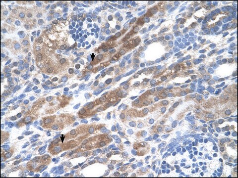 Anti-KIAA0319 antibody produced in rabbit IgG fraction of antiserum