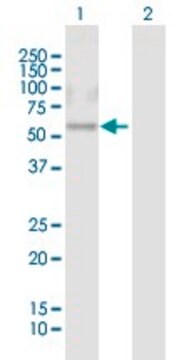 Anti-CRISPLD1 antibody produced in mouse purified immunoglobulin, buffered aqueous solution