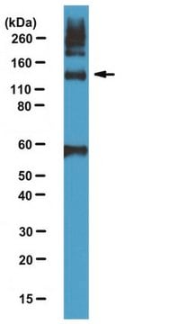 Anti-Tie-2 Antibody, NT from rabbit, purified by affinity chromatography