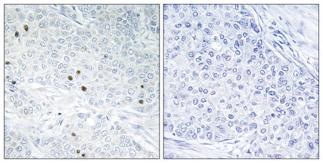 Anti-TP53INP2 antibody produced in rabbit affinity isolated antibody