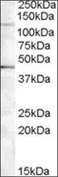 Anti-TNKS2 antibody produced in goat affinity isolated antibody, buffered aqueous solution