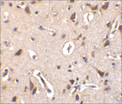 Anti-ILPIP antibody produced in rabbit affinity isolated antibody, buffered aqueous solution