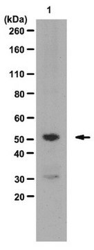 Anti-KLF5 (Kr&#252;ppel-like factor 5) Antibody serum, from rabbit