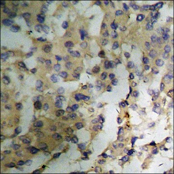 Anti-phospho-PKC &#950; (pThr410) antibody produced in rabbit affinity isolated antibody