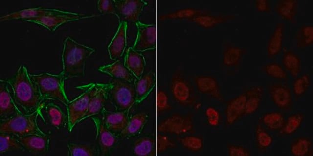 Anticorps anti-phospho-histone&nbsp;H3 (Ser10), clone&nbsp;3H10, Alexa Fluor&#8482;&nbsp;555 clone 3H10, from mouse, ALEXA FLUOR&#8482; 555