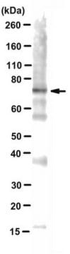 Anticuerpo anti-alfa-sinucleína, específico del oligómero Syn33 from rabbit