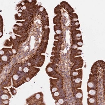 Anti-SMG1 antibody produced in rabbit Prestige Antibodies&#174; Powered by Atlas Antibodies, affinity isolated antibody, buffered aqueous glycerol solution