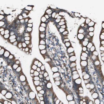 Anti-UTS2 antibody produced in rabbit Prestige Antibodies&#174; Powered by Atlas Antibodies, affinity isolated antibody, buffered aqueous glycerol solution