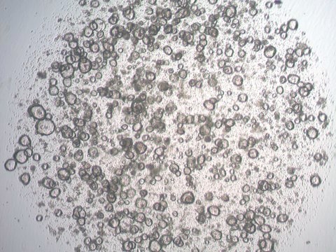 3dGRO Stomach Gastric Organoids, Age 60 (Prep ht-129-S)