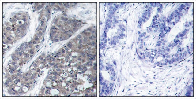 Anti-PTK2B (Ab-402) antibody produced in rabbit affinity isolated antibody