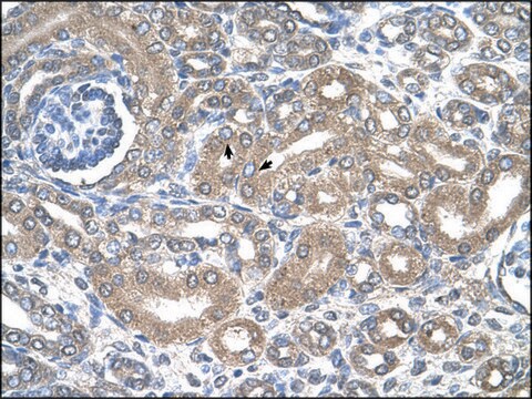 Anti-SLC12A1 antibody produced in rabbit affinity isolated antibody