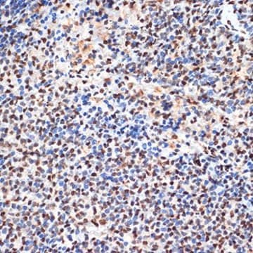 Anti-ANP32B antibody produced in rabbit