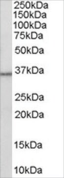 Anti-HSD11B1/HDL antibody produced in goat affinity isolated antibody, buffered aqueous solution