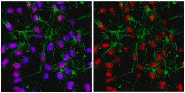 Anti-IKAROS Antibody from rabbit, purified by affinity chromatography