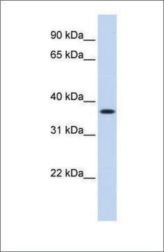 Anti-MTHFD2 (ab3) antibody produced in rabbit affinity isolated antibody