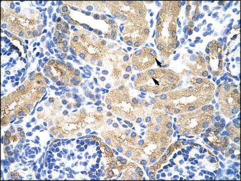 Anti-MTHFSD antibody produced in rabbit IgG fraction of antiserum