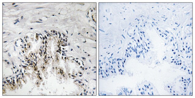 Anti-RPL31 antibody produced in rabbit affinity isolated antibody