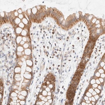 Anti-PPM1K antibody produced in rabbit Prestige Antibodies&#174; Powered by Atlas Antibodies, affinity isolated antibody, buffered aqueous glycerol solution, Ab3