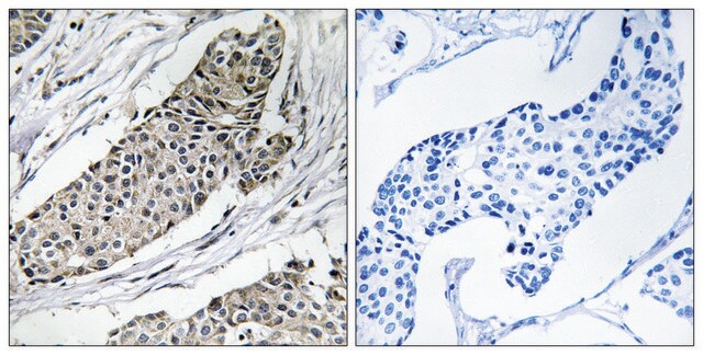 Anti-KCNAB3 antibody produced in rabbit affinity isolated antibody